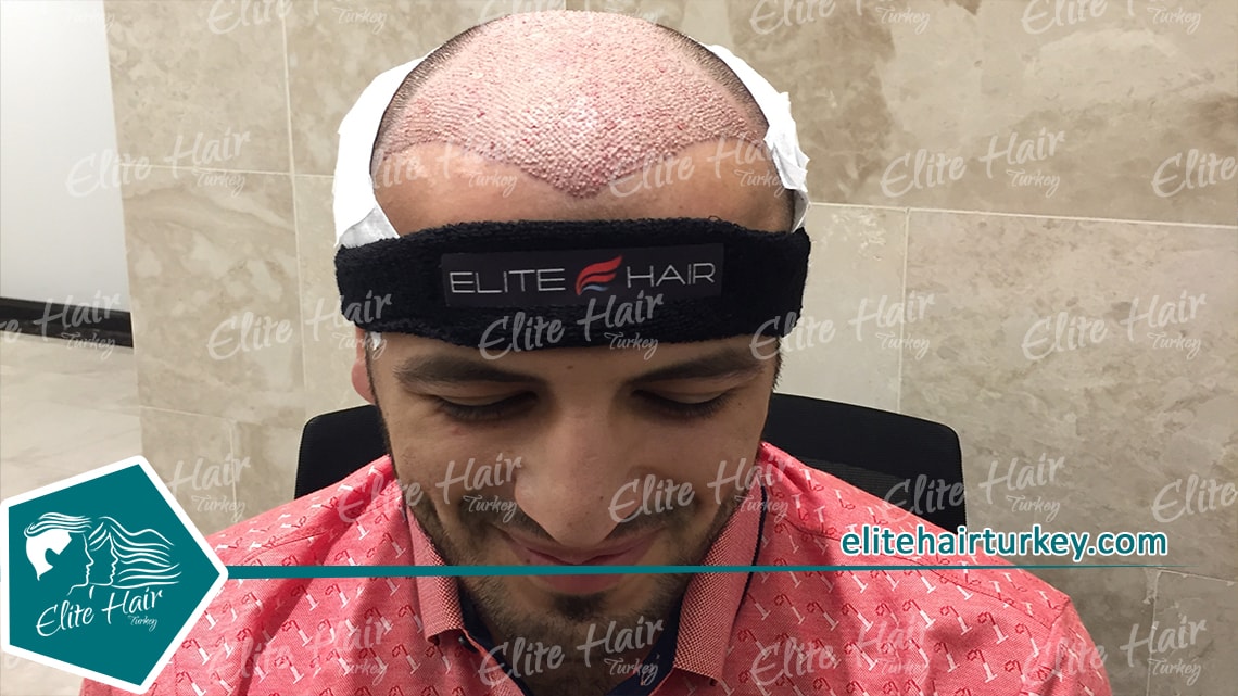 Elite Hair Turkey
